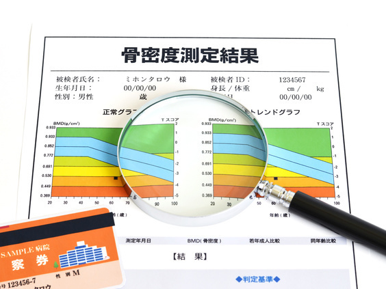 骨密度検査